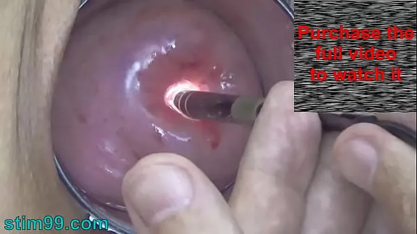 HD Endoscope Camera inside Cervix Cam into Pussy Uterus mega Clips