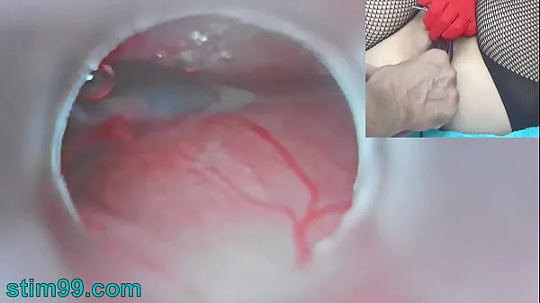 HD Uncensored Japanese Insemination with Cum into Uterus and Endoscope Camera by Cervix to watch inside womb mega Clips
